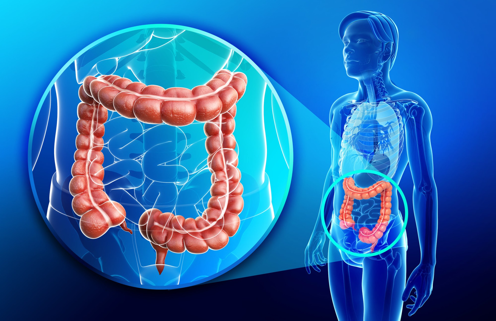 Những Nhóm Người Có Nguy Cơ Mắc Ung Thư Đại Trực Tràng Cao
