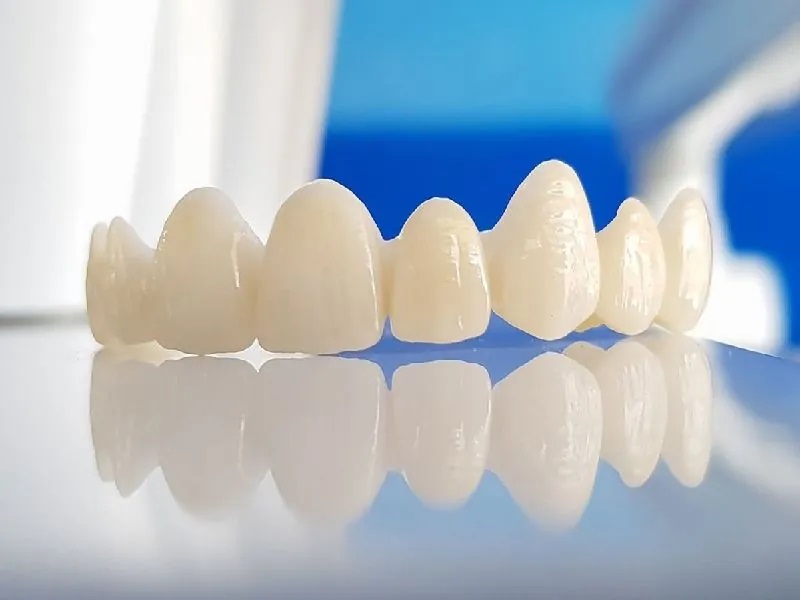 Bác sĩ CKI Trương Chí Bảo tư vấn: Bọc răng sứ loại nào tốt? Bảng giá và tiêu chí chọn răng sứ phù hợp- Ảnh 2.