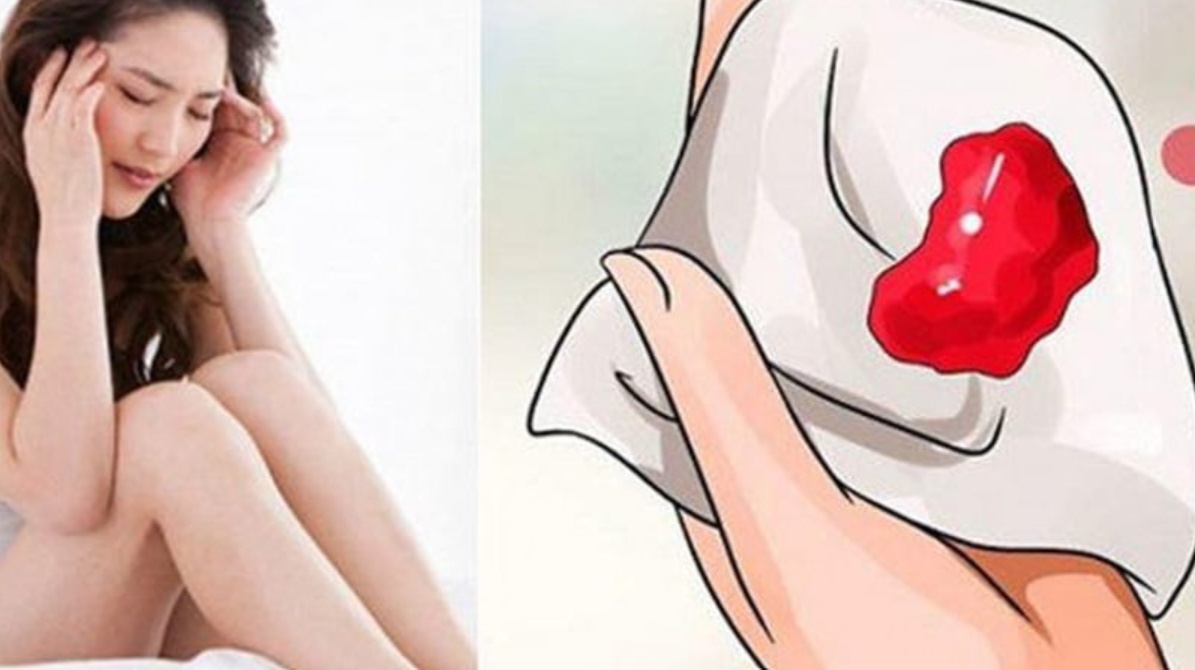 Kinh nguyệt có cục máu đông có bình thường không? - Ảnh 1.
