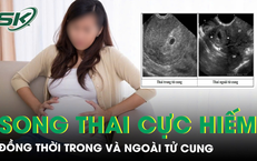 Nguy Cơ Từ Tai Nạn Giao Thông: Cảnh Báo Về Tình Huống Nguy Kịch