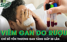 Kỳ Diệu và Kinh Hoàng: Câu Chuyện Về Người Đàn Ông Mang Sán Dây Trong Cơ Thể Suốt 12 Năm