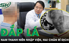 Khám Phá Những Loại Cá Giá Rẻ Bổ Dưỡng tại Việt Nam