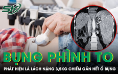 Những Nguy Cơ Sức Khỏe Của Lối Sống Thiếu Lành Mạnh Ở Giới Trẻ
