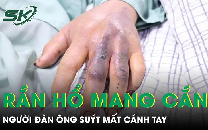 CSGT Hà Nội hỗ trợ cấp cứu người bị rắn cắn - Ảnh 1.