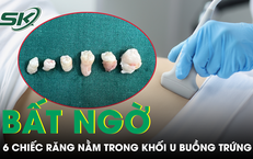 Lý Do Kỳ Quặc Khiến Một Người Đàn Ông Cần Cấp Cứu Sau Khi Thử Nghiệm Kỹ Thuật Khó Đỡ