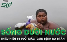 Nguy Cơ Suy Thận: Cảnh Báo Hậu Quả Từ Thói Quen Ăn Uống