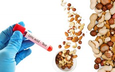 Bệnh Viện S.I.S Cần Thơ Nhận Chứng Nhận SILC: Đột Phá Trong Chăm Sóc Đột Quỵ