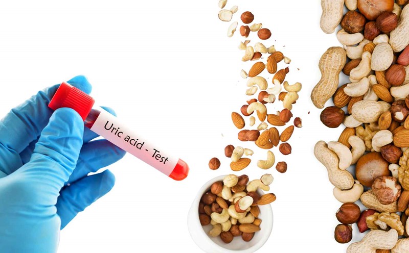 Những Nguyên Nhân Khác Gây Ra Tăng Acid Uric Mà Bạn Chưa Biết