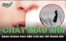 Nguy cơ mất thị lực từ những trò chơi nguy hiểm ở trẻ em