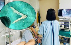 Cải Cách Pháp Luật Về Thuốc Lá: Hướng Tới Một Thế Hệ Khỏe Mạnh Hơn
