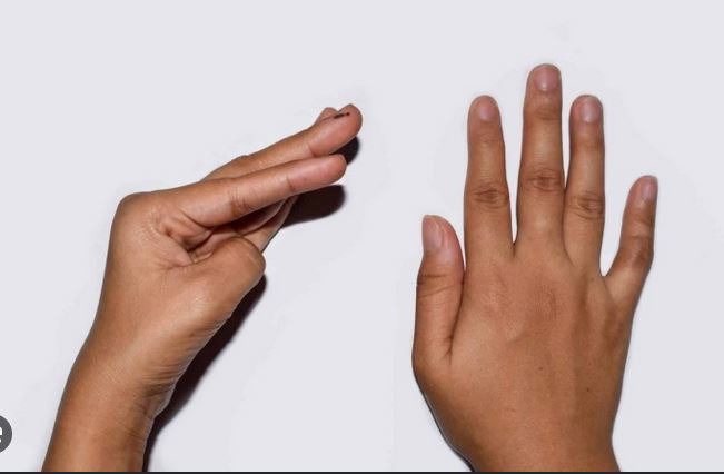 Phân Biệt Giữa Hạ Kali và Hạ Canxi: Những Dấu Hiệu Cần Nhận Biết