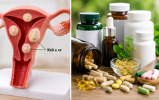 Những Thực Phẩm Bổ Sung Không Nên Kết Hợp Với Canxi