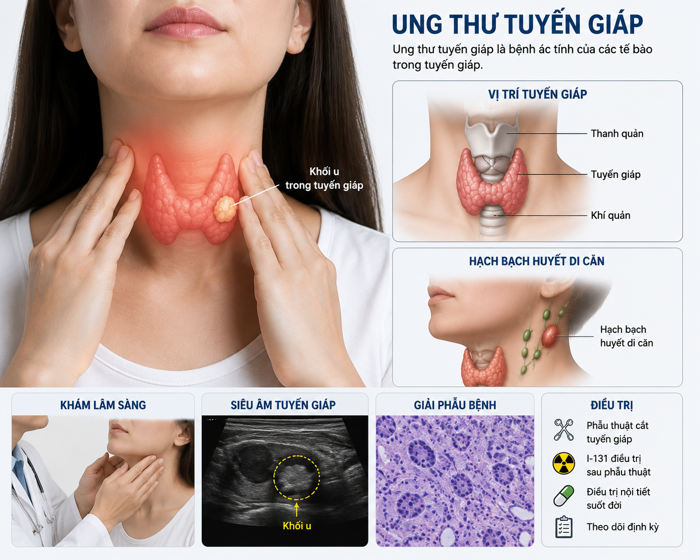 Những Ai Cần Điều Trị I-131 Sau Phẫu Thuật Ung Thư Tuyến Giáp?