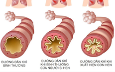 Những Dấu Hiệu Nguy Cơ Khi Trẻ Sặc Nước: Cha Mẹ Cần Hành Động Ngay
