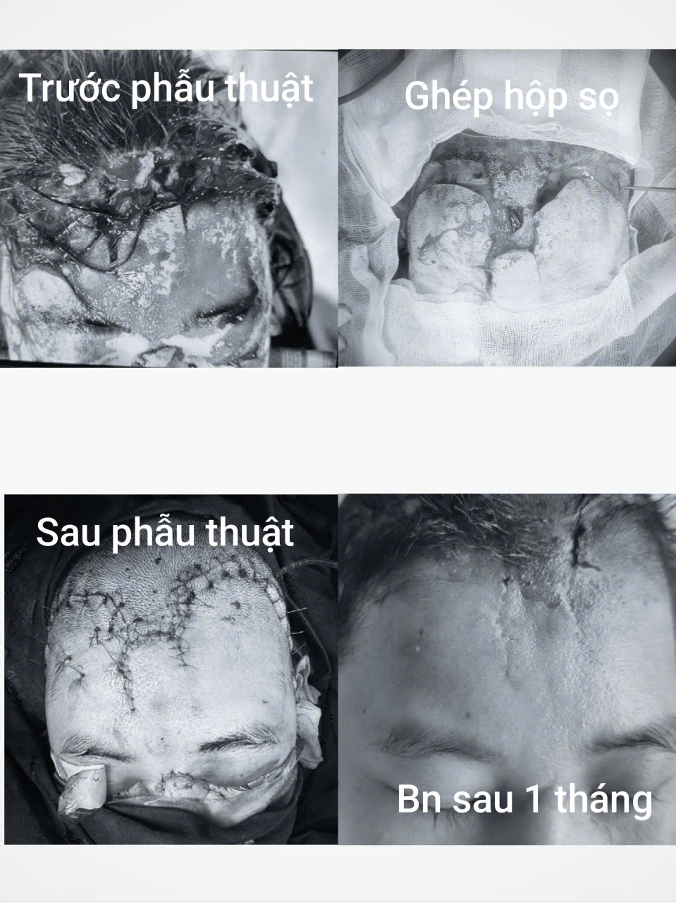 Cận cảnh chấn thương trước và sau phẫu thuật
