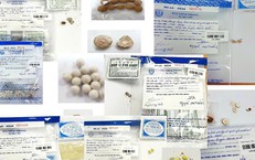 Giun Rồng: Ca Thứ 44 Tại Việt Nam và Những Điều Cần Biết
