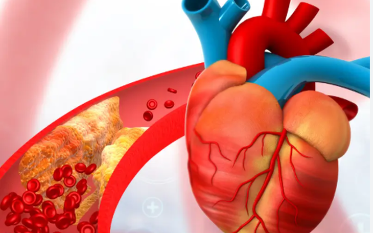 Liên hệ giữa sức mạnh cơ bắp và nguy cơ bệnh tim mạch