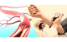 Tại Sao Khám Sức Khỏe Định Kỳ Là Cần Thiết Dù Bạn Khỏe Mạnh?