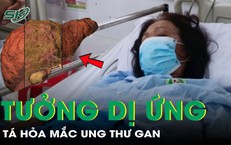 Chia Sẻ Câu Chuyện Về Người Mẹ 31 Tuổi Phải Cắt Toàn Bộ Dạ Dày