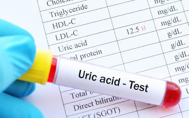 Tác Động Của Nước Chanh Mật Ong Đến Mức Acid Uric: Điều Cần Biết - Ảnh 3.