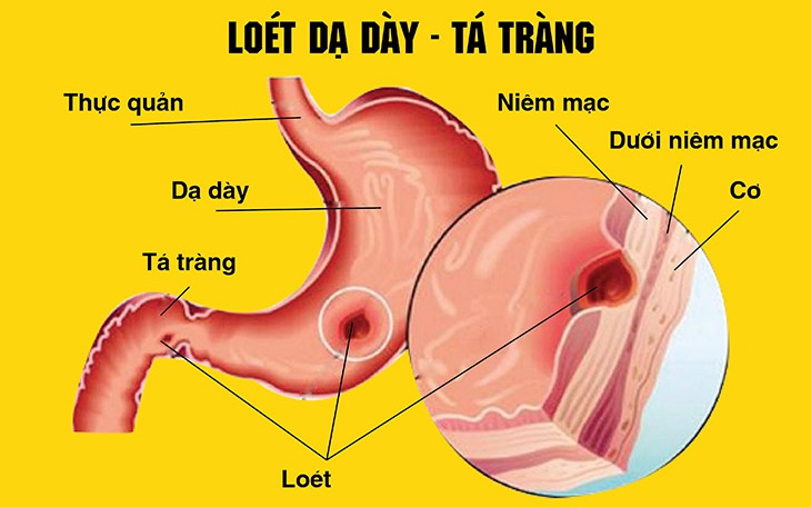 Cây Xấu Hổ: Tác Dụng Chữa Bệnh Và Những Bài Thuốc Hay