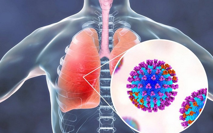 Cảnh Giác với Viêm Phổi do Adenovirus ở Trẻ Nhỏ: Dấu Hiệu và Biện Pháp Phòng Ngừa