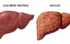 Tác Động Của Ca Đêm Đến Sức Khỏe Và Cách Khắc Phục
