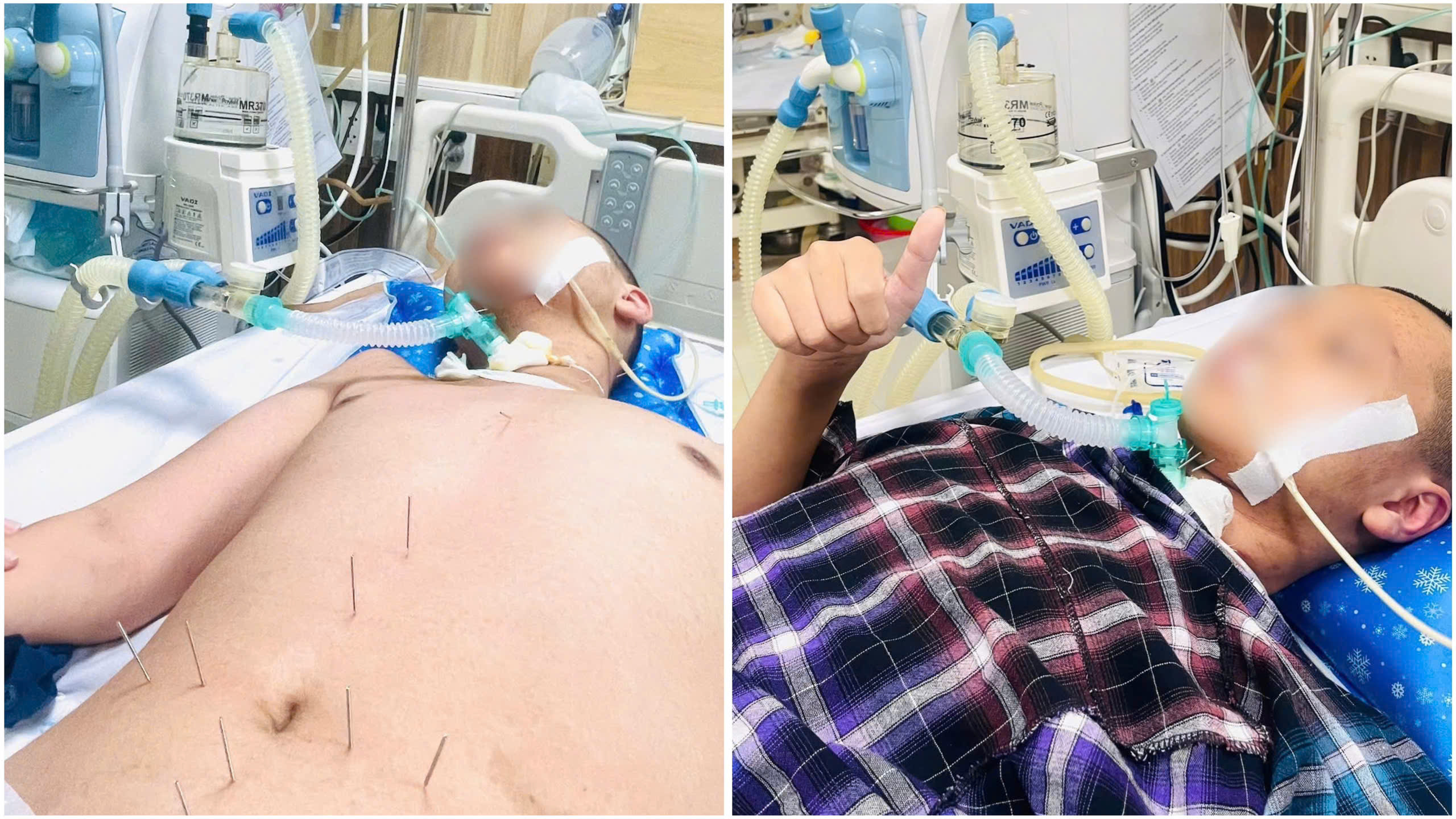 Bé trai Hải Phòng hồi phục tích cực sau viêm não nặng- Ảnh 1.