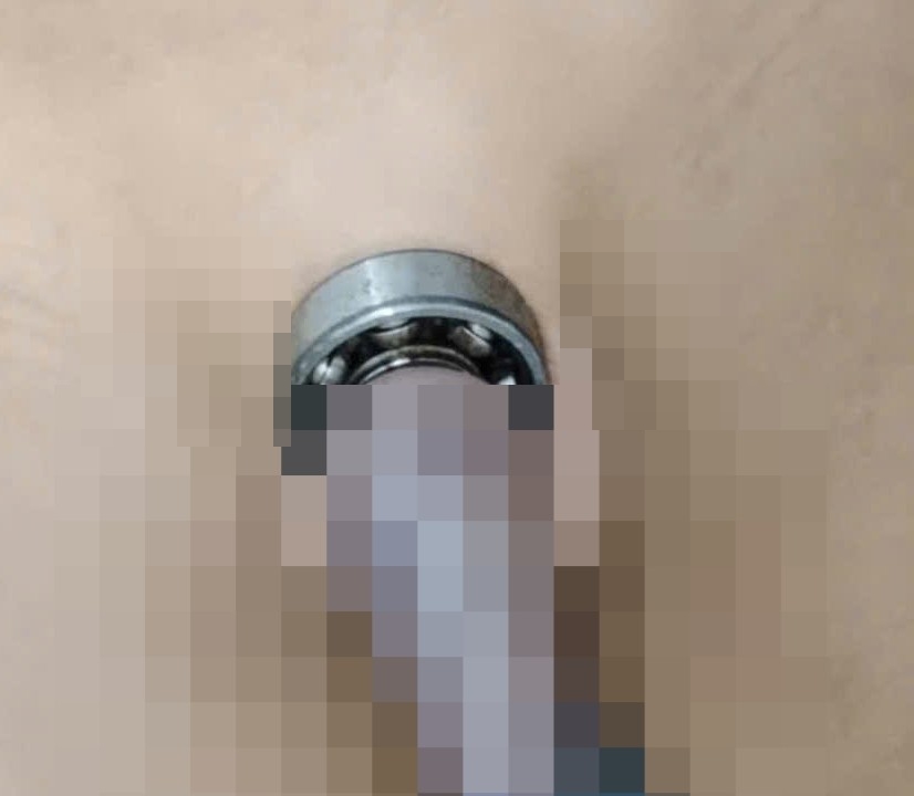 Bé trai 10 tuổi gặp tai nạn hy hữu ở vùng kín vì nghịch vòng bi- Ảnh 1