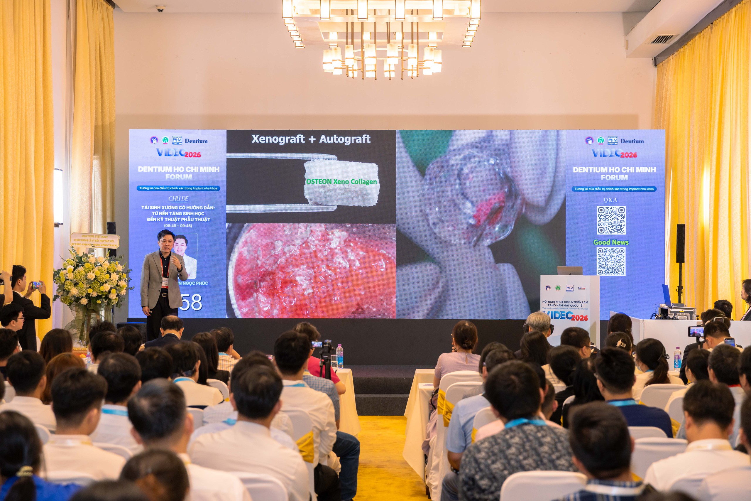anh-2-1788506749173704326830 Dentium đồng hành cùng nha khoa Việt Nam qua chuỗi dấu ấn tại VIDEC 2026- Ảnh 2.