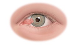 Cải thiện mất ngủ: Chiến lược thói quen hàng ngày và dấu hiệu cần khám