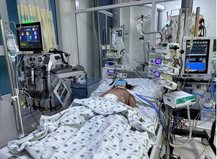 sxh-1-17887468842241662691053 Cao điểm mùa mưa, liên tục tiếp nhận trẻ sốt xuất huyết nặng - Ảnh 2.