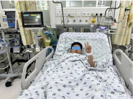 Sốt xuất huyết nặng ở trẻ: nhận diện sớm, biến chứng và can thiệp đã cứu sống hai trường hợp