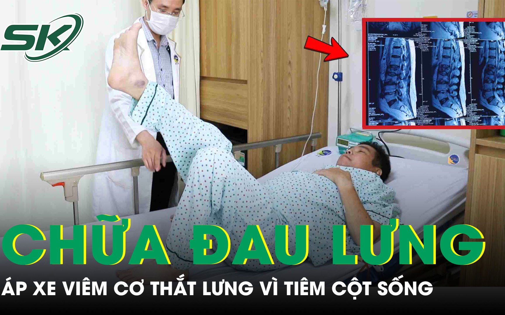 Phẫu thuật trượt đốt sống nhờ nội soi một cổng- Ảnh 3.